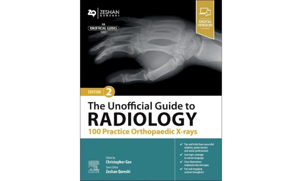 Buy The Unofficial Guide to Radiology: 100 Practice Orthopaedic X